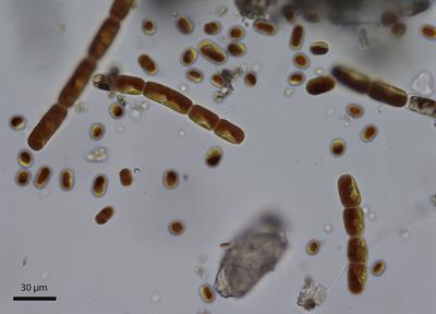 A DUF3494 ice-binding protein with a root cap domain in a streptophyte glacier ice alga